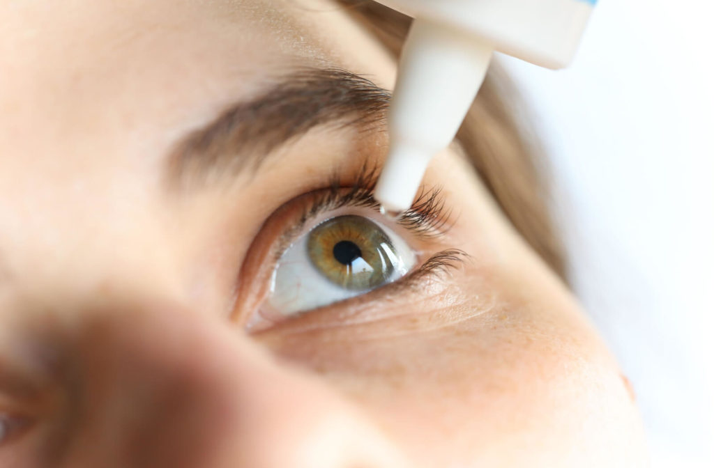A close-up of a woman applying eye drops to her eyes.